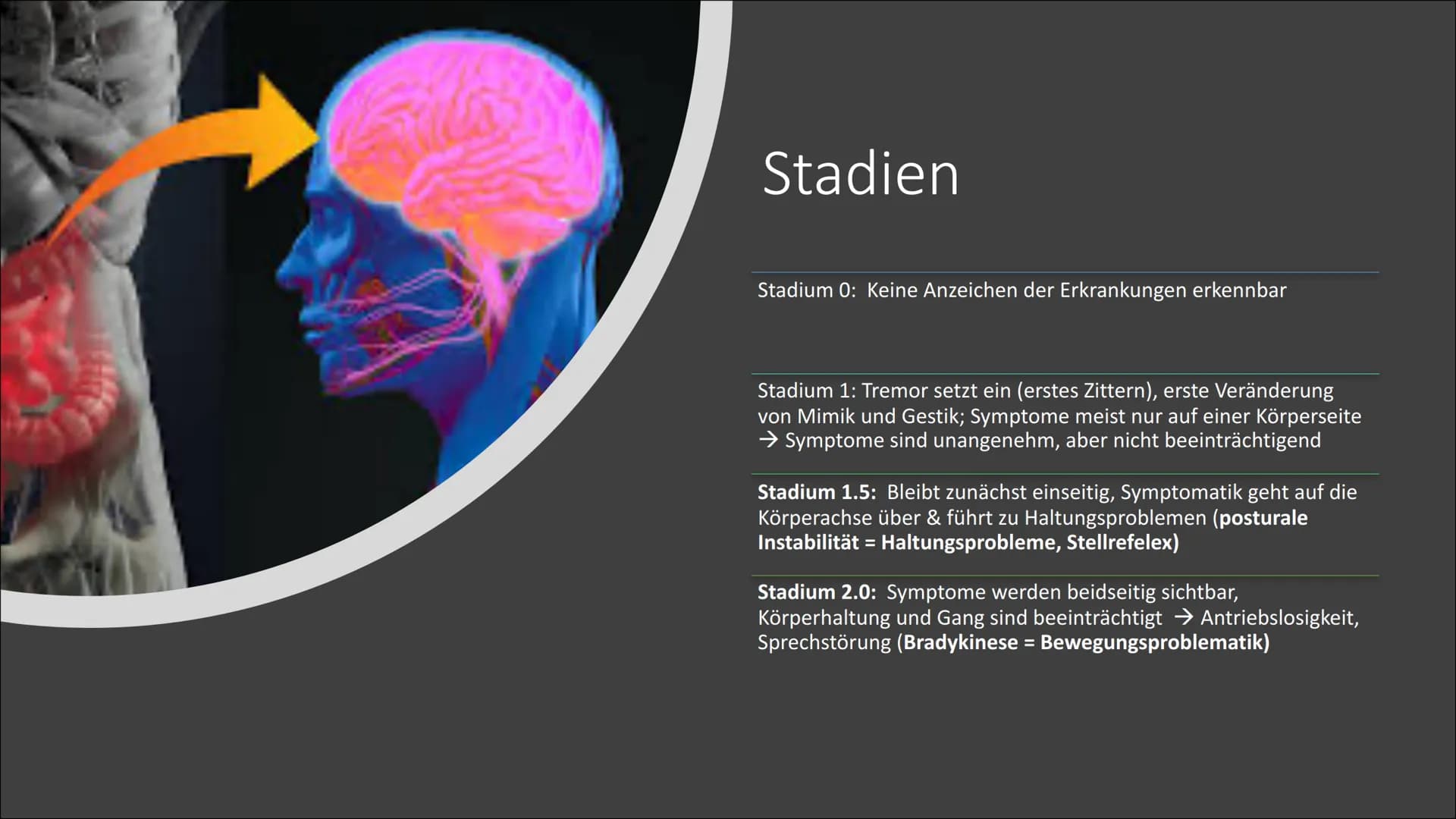 Parkinson Gliederung
●
Parkinson - Was ist das?
Symptome
Ursachen, Risiko Faktoren
Stadien
Syndrome
Behandlungsmethoden
• Neuronale Wirkung
