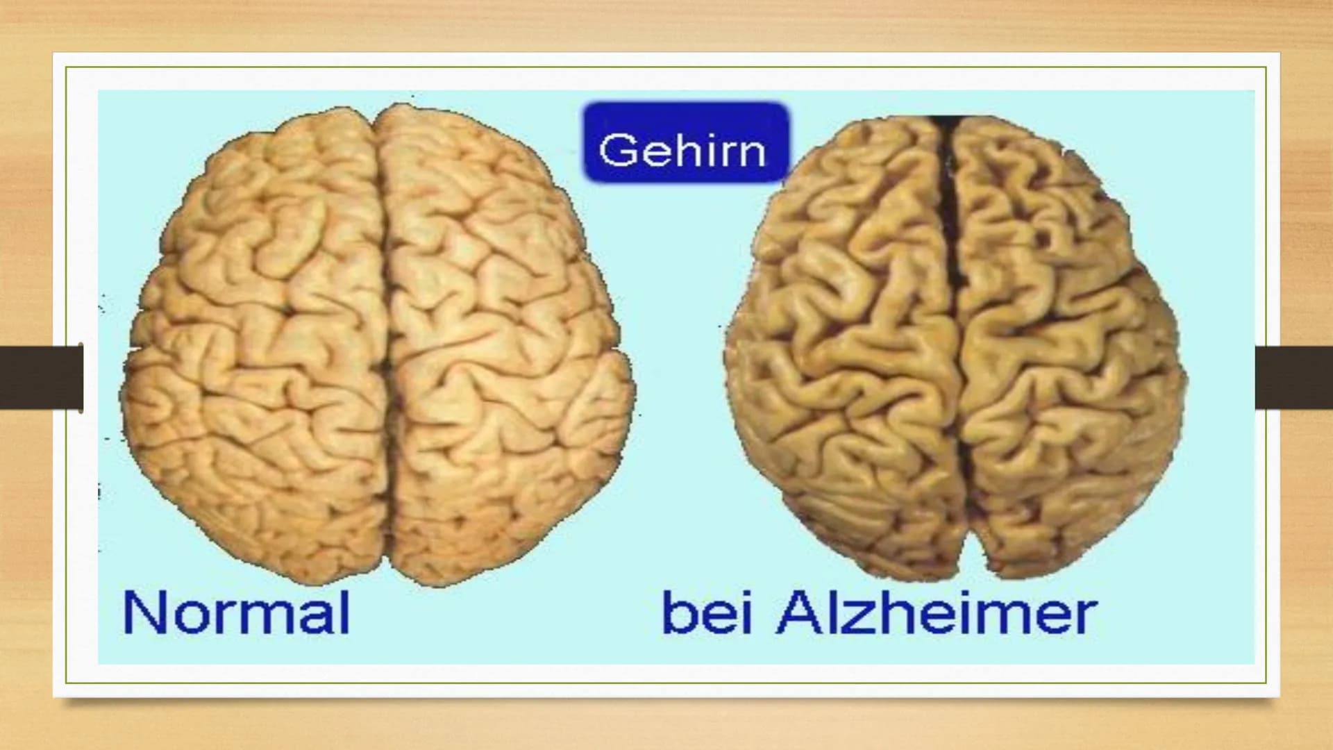 Demenz Demenz- Zahlen
Test
Zahlen-Test
Aufgabe: Merkt euch die Zahlen
▪ 57
▪83
48
▪
43
▪ 96 Definition
• wörtliche Übersetzung aus dem Latei