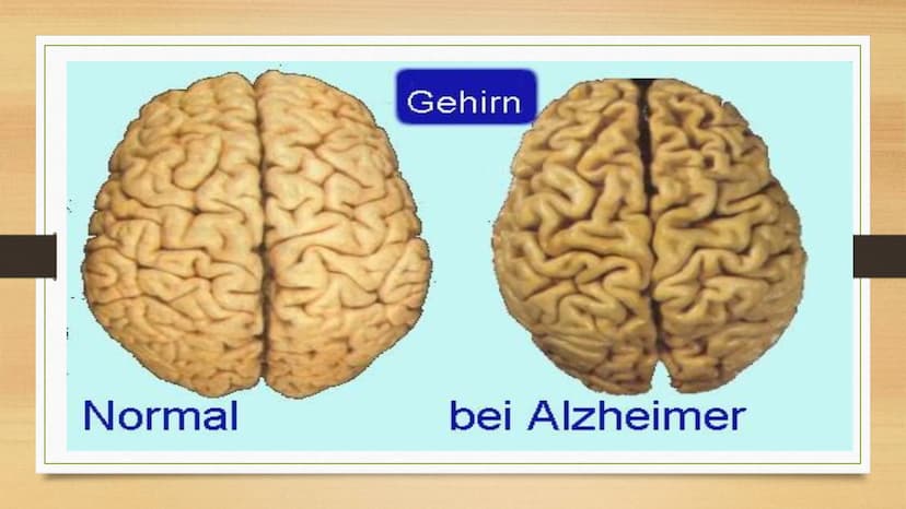 Demenz Demenz- Zahlen
Test
Zahlen-Test
Aufgabe: Merkt euch die Zahlen
▪ 57
▪83
48
▪
43
▪ 96 Definition
• wörtliche Übersetzung aus dem Latei