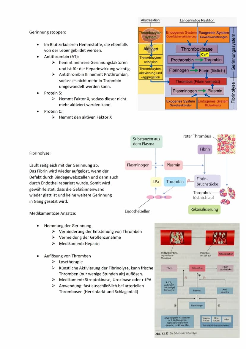 CE 05, LS 5.3.2 Thromboseprophylaxe
Thrombus:
Blutgerinnsel (,,Blutpfropf") in einem Gefäß. Er kann in Venen und Arterien entstehen.
Thrombo