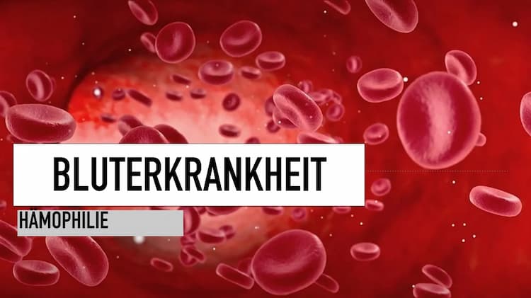 Know Bluterkrankheit Hämophilie thumbnail