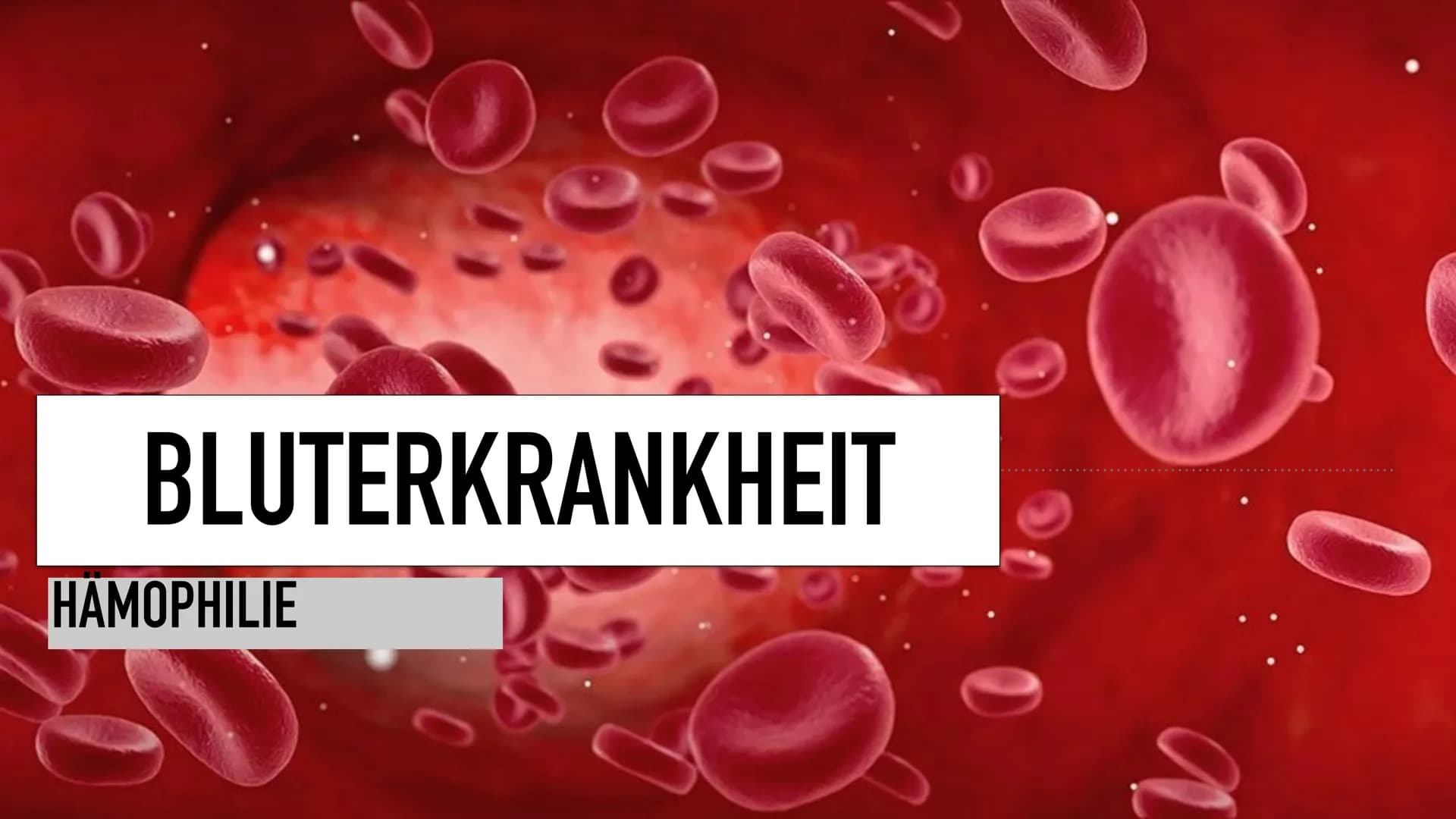 BLUTERKRANKHEIT
HAMOPHILIE
0
a INHALT
Was ist Hämophilie?
Was sind die Ursachen?
➤ Was sind die Symptome?
Wie Häufig ist die Krankheit? WAS 