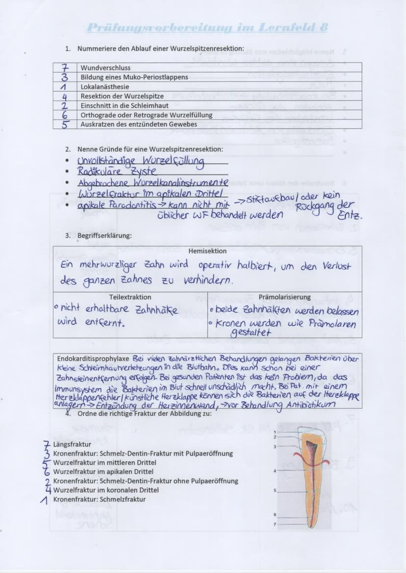 Prüfungsvorbereitung im Lernfeld 8
1. Nummeriere den Ablauf einer Wurzelspitzenresektion:
Wundverschluss
Bildung eines Muko-Periostlappens
L