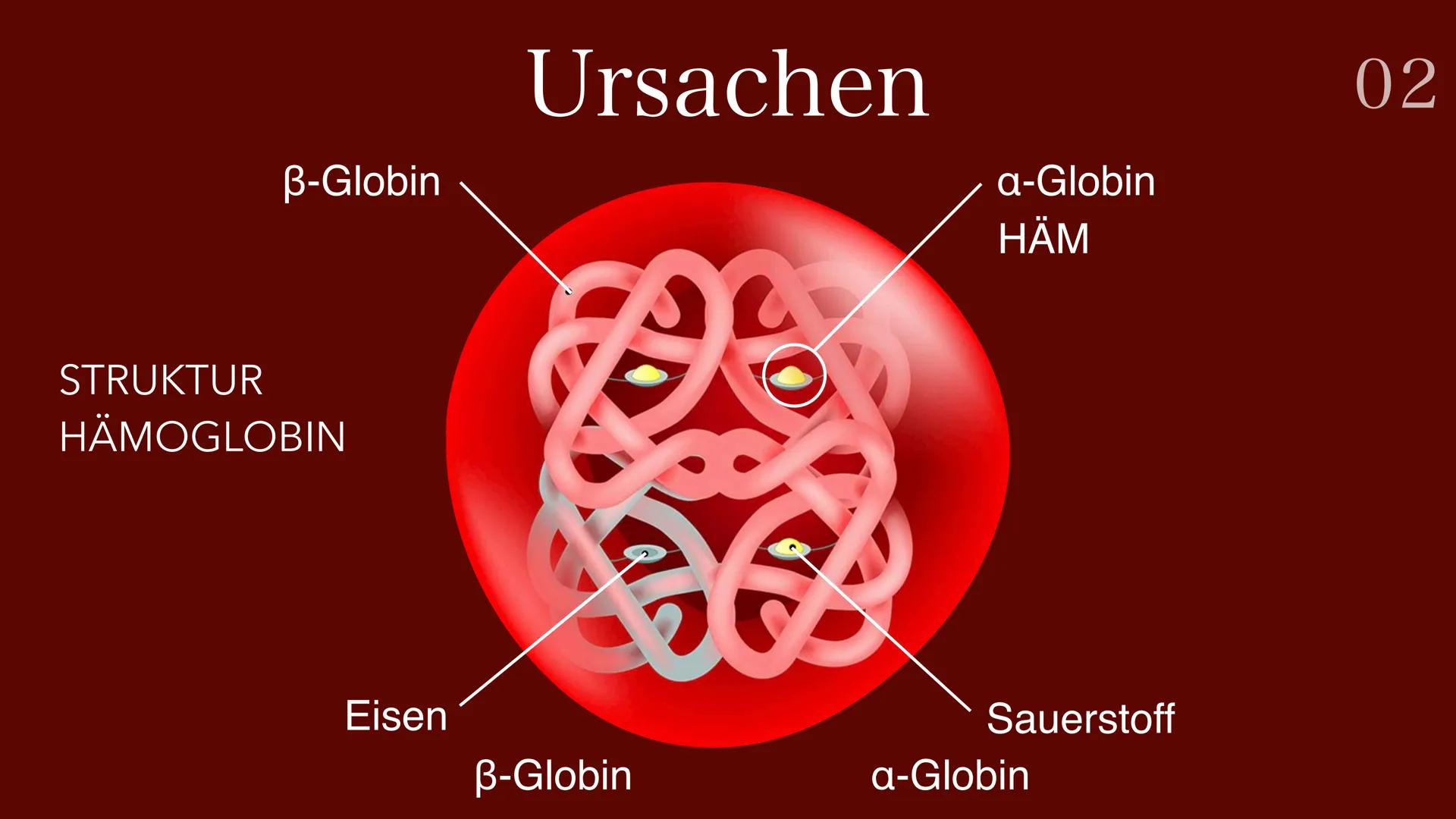 Sichelzellenanämie # Gliederung

## 01
Definition

## 02
Ursachen

## 03
Symptome

## 04
Verbreitung

## 05
Malaria

## 06
Behandlung 01 Def
