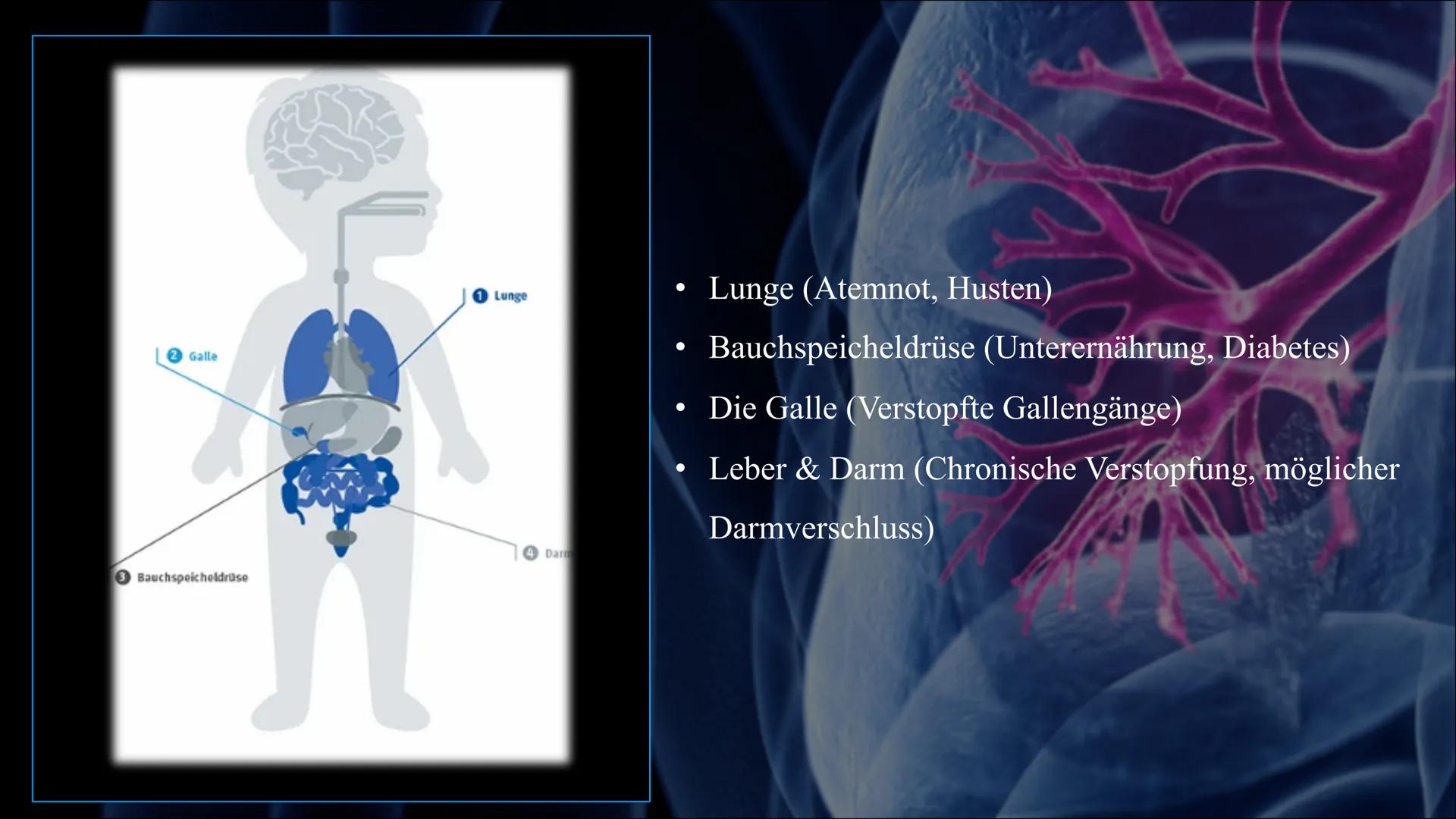 Mukoviszidose # Inhalt

• Was ist Mukoviszidose?
• Ursachen
• Genetische Vererbung
• Symptome
• Diagnoseverfahren
• Behandlungsmöglichkeiten