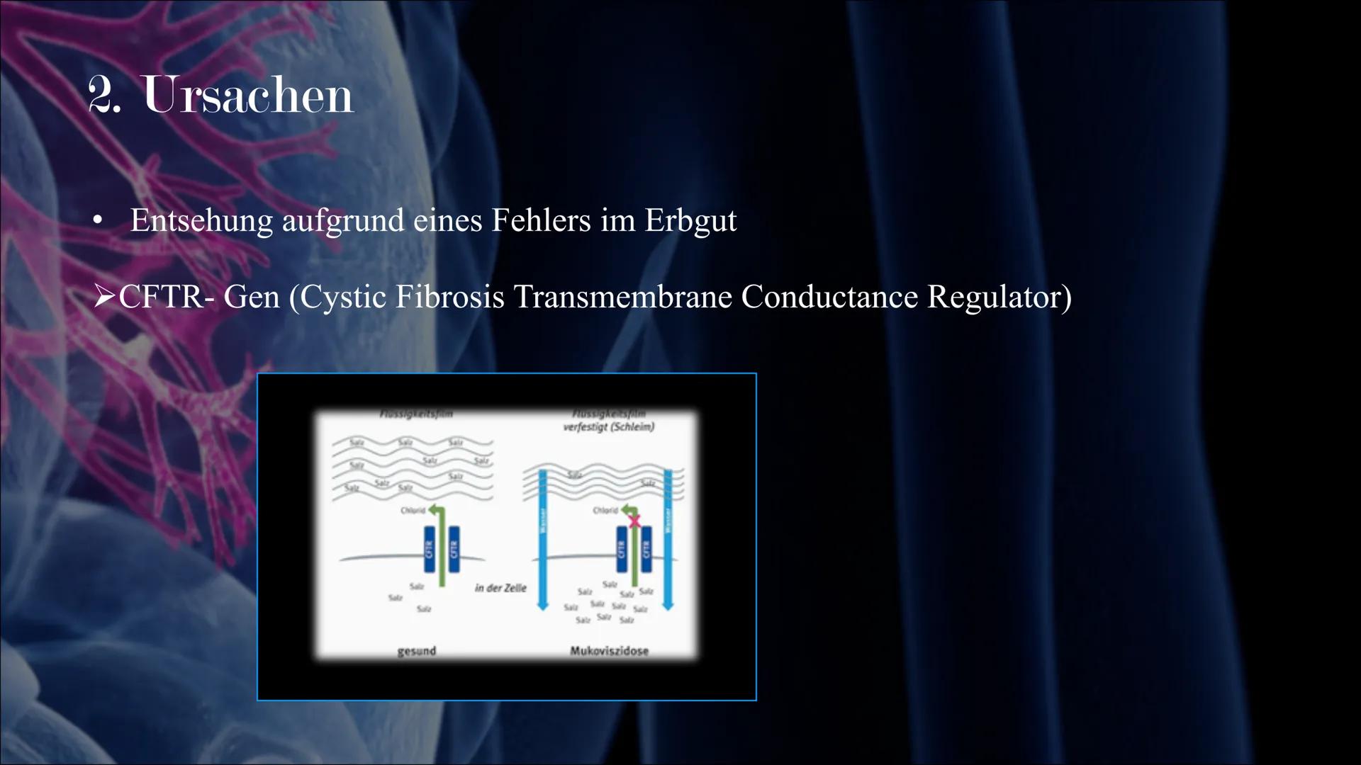 Mukoviszidose # Inhalt

• Was ist Mukoviszidose?
• Ursachen
• Genetische Vererbung
• Symptome
• Diagnoseverfahren
• Behandlungsmöglichkeiten