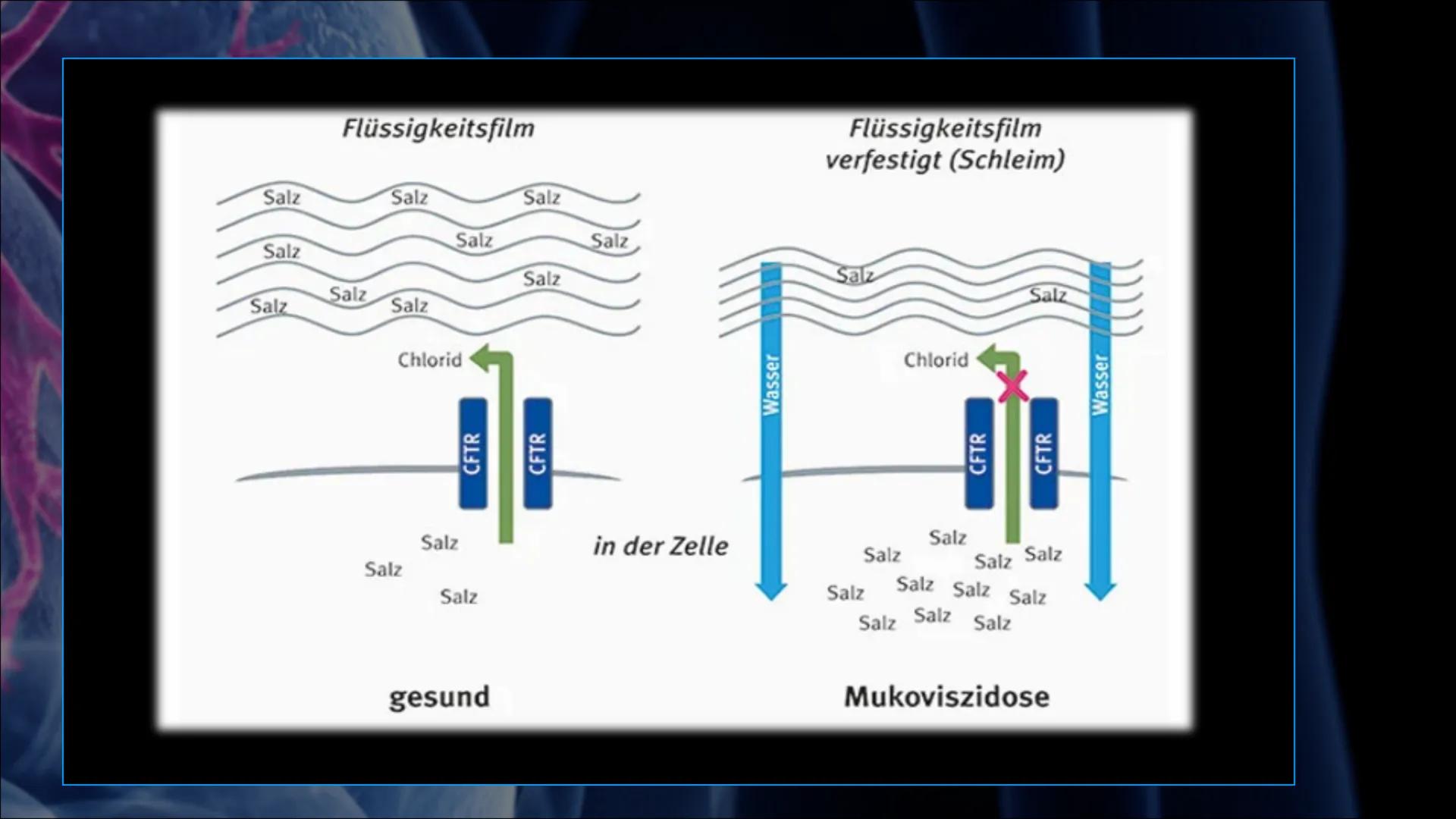 Mukoviszidose # Inhalt

• Was ist Mukoviszidose?
• Ursachen
• Genetische Vererbung
• Symptome
• Diagnoseverfahren
• Behandlungsmöglichkeiten