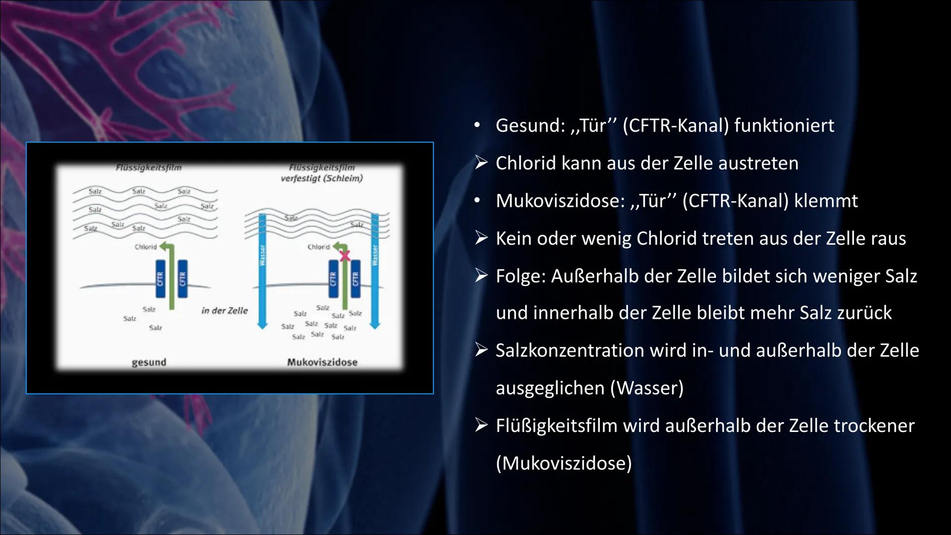Mukoviszidose # Inhalt

• Was ist Mukoviszidose?
• Ursachen
• Genetische Vererbung
• Symptome
• Diagnoseverfahren
• Behandlungsmöglichkeiten