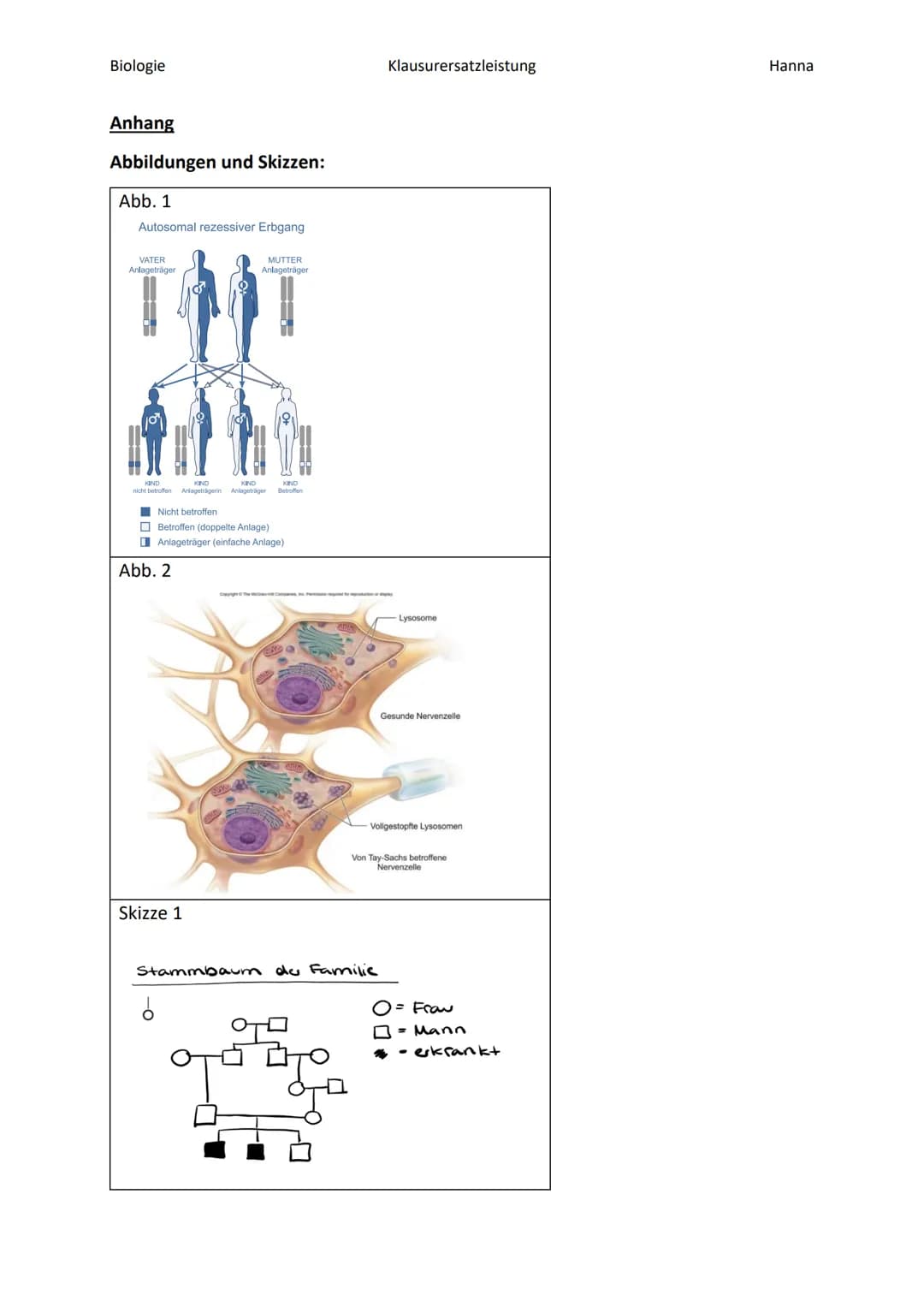 Biologie
Klausurersatzleistung
Informationstext: TAY-SACHS-Syndrom
Fallbeispiel zur Klausur:
Arbeitsmaterial:
Hanna
Quelle: Handbuch Kursunt