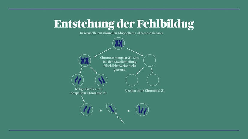 Trisomie 21
Down-Syndrom
Zoe, Louisa, Alina, Linda, La Toya, Talida, Emma, Diana Gliederung
- Definition
- Krankheitsbild
- Entstehung der F