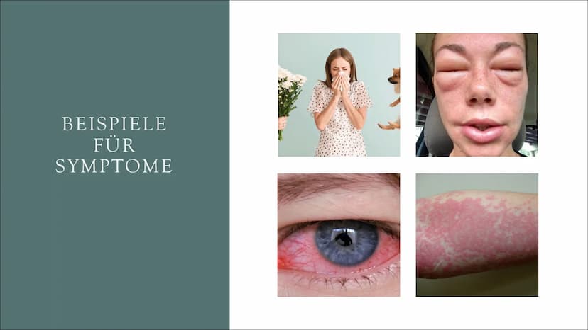 ALLERGIE • Definition & Grundlagen
●
Entstehung einer Allergie
Arten einer Allergie
Häufige Symptome
Beispiele der Symptome
Diagnose & Test
