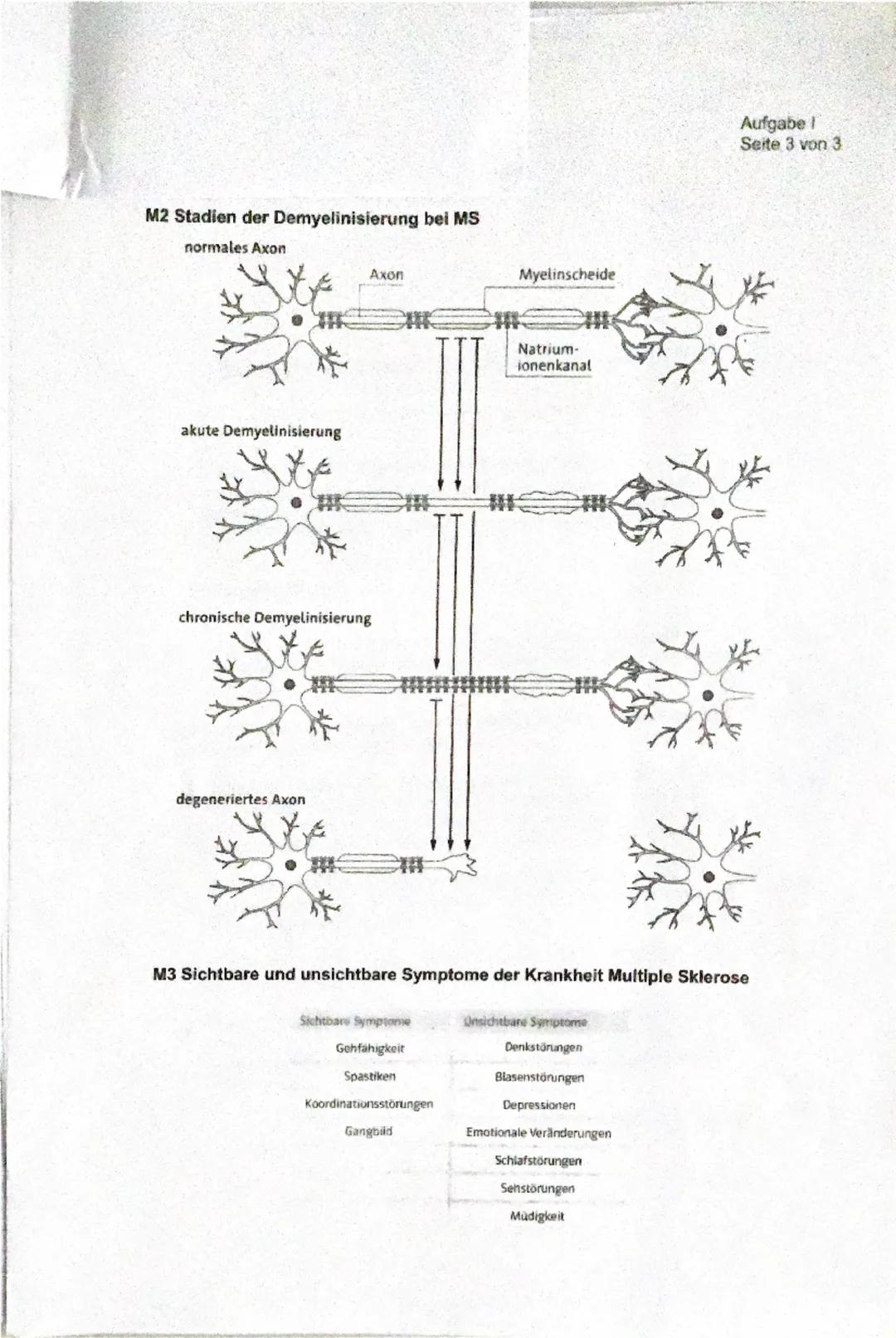 1 Multiple Sklerose
Teilaufgabe Anforderungen: Die Schülerin/ der Schüler
BE max
BE
Erläutert die grundsätzlichen Funktionen des Neurons...
