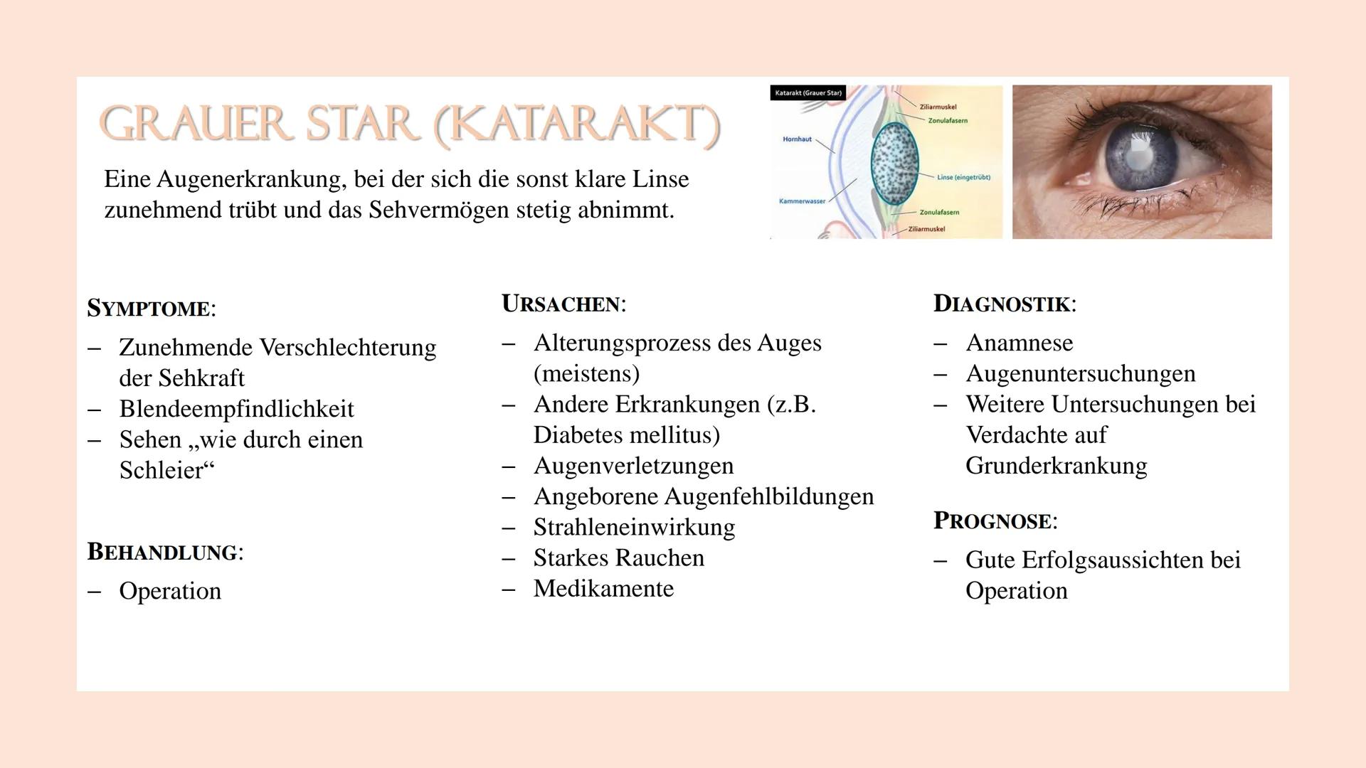 GRAUER STAR (KATARAKT)
Eine Augenerkrankung, bei der sich die sonst klare Linse
zunehmend trübt und das Sehvermögen stetig abnimmt.
SYMPTOME