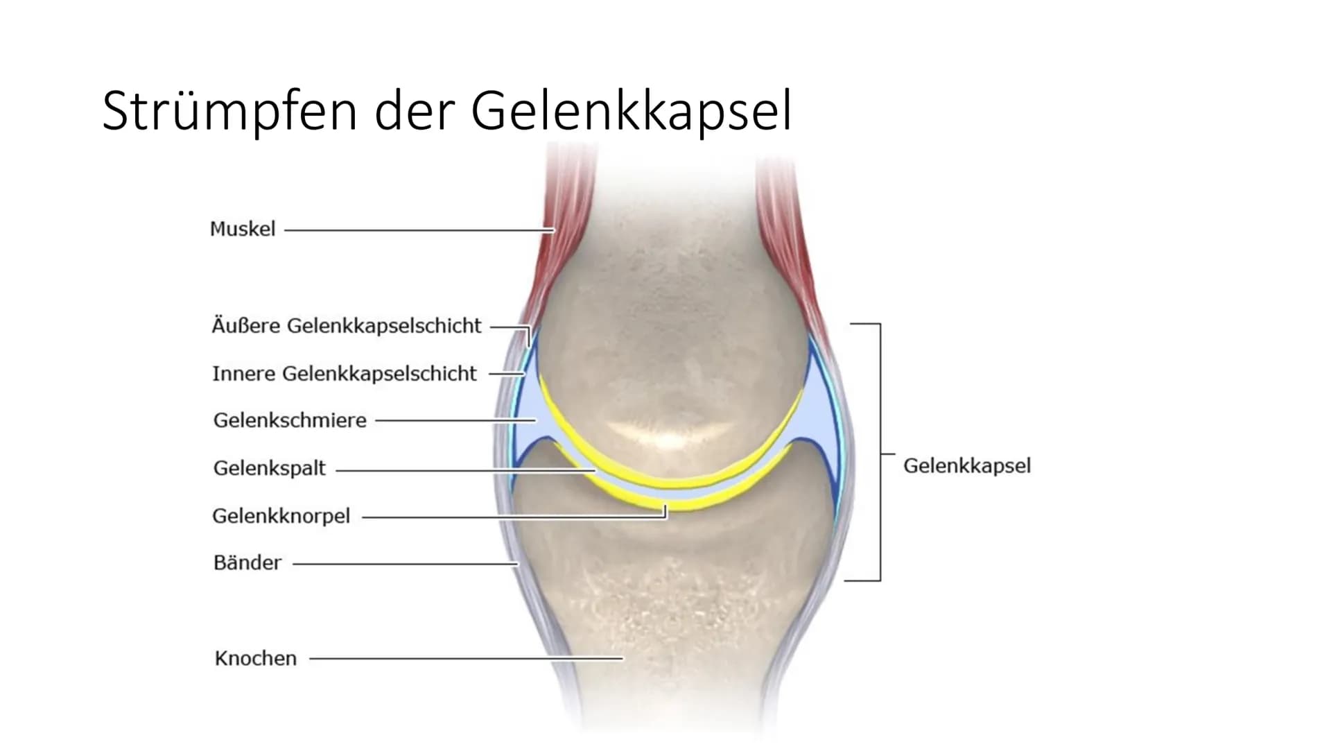 KONTRAKTURPROPHYLAXE Gliederung
• Thema/Problem
●
●
Ursachen und Risikofaktoren
Symptome und Auswirkungen
Maßnahmen
Übungen
on 1. Thema/Prob