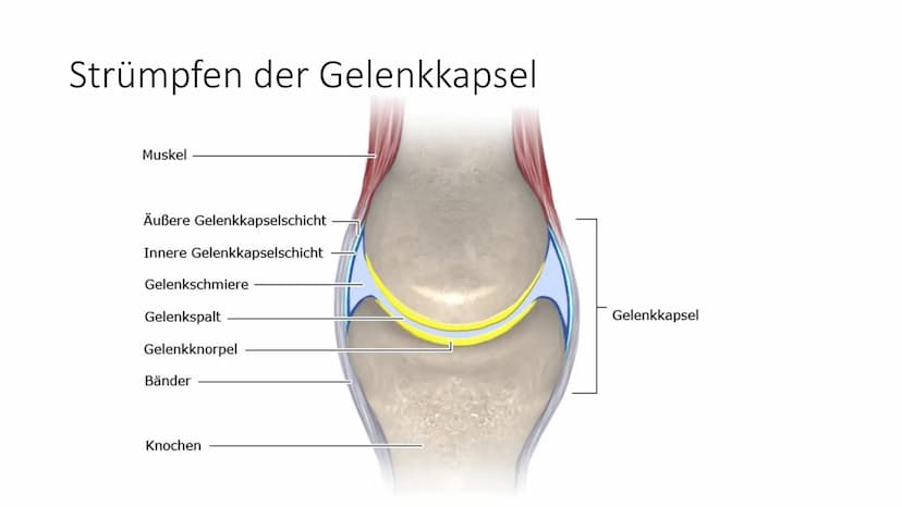 KONTRAKTURPROPHYLAXE Gliederung
• Thema/Problem
●
●
Ursachen und Risikofaktoren
Symptome und Auswirkungen
Maßnahmen
Übungen
on 1. Thema/Prob