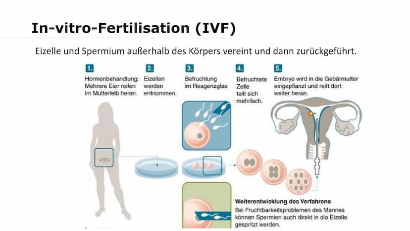 Wer von euch möchte mal Kinder haben? Was macht ihr, wenn es nicht funktioniert? Gliederung
➤Reproduktionsmedizin
Retorten-Baby
> Methoden:
