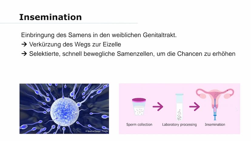 Wer von euch möchte mal Kinder haben? Was macht ihr, wenn es nicht funktioniert? Gliederung
➤Reproduktionsmedizin
Retorten-Baby
> Methoden:
