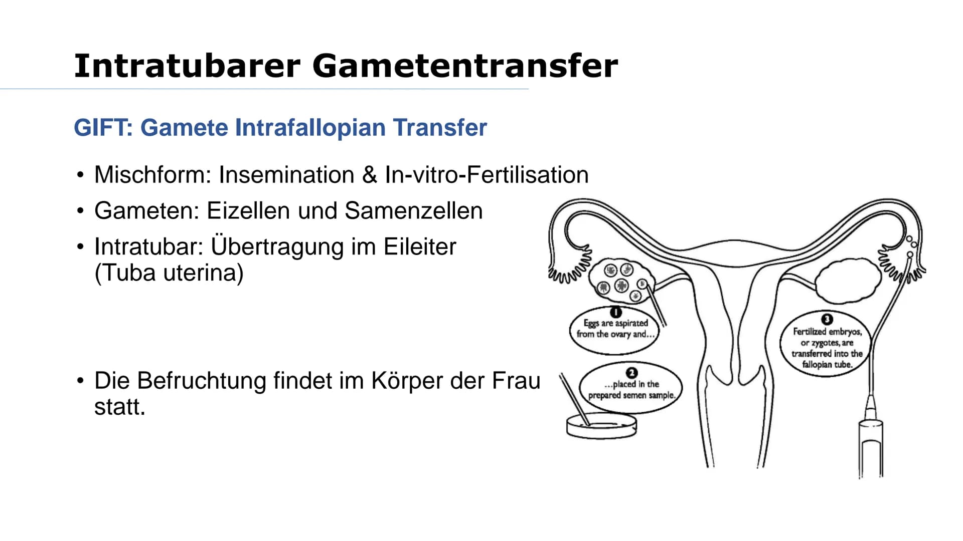 Wer von euch möchte mal Kinder haben? Was macht ihr, wenn es nicht funktioniert? Gliederung
➤Reproduktionsmedizin
Retorten-Baby
> Methoden:
