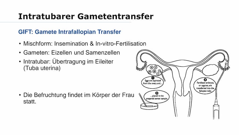 Wer von euch möchte mal Kinder haben? Was macht ihr, wenn es nicht funktioniert? Gliederung
➤Reproduktionsmedizin
Retorten-Baby
> Methoden:
