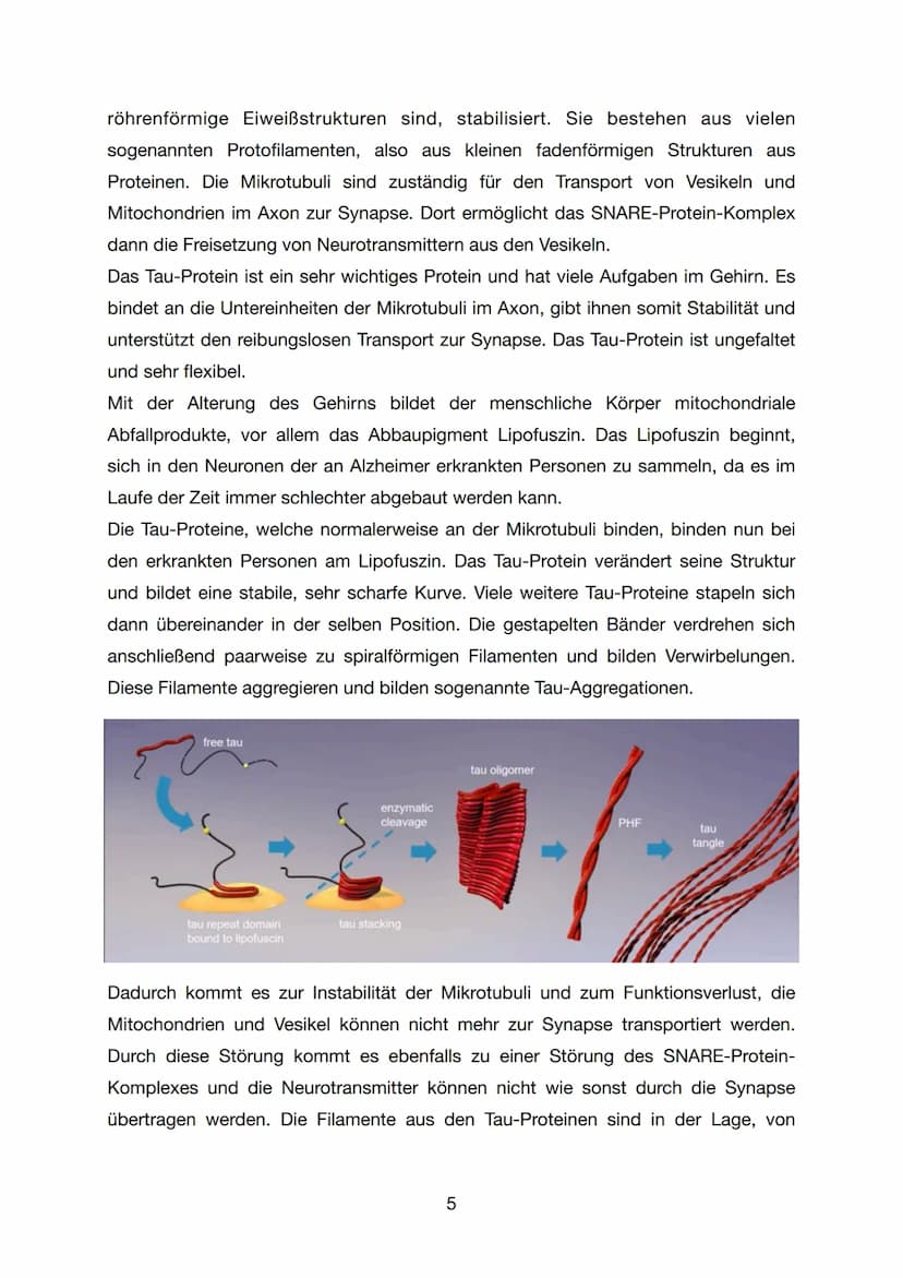 GFS - Biologie
Alzheimer
K1
07. Juli 2021
1 Inhaltsverzeichnis
1. Einleitung..
2. Hauptteil.
2.1 Was ist Alzheimer / Demenz...
2.2 Forschung