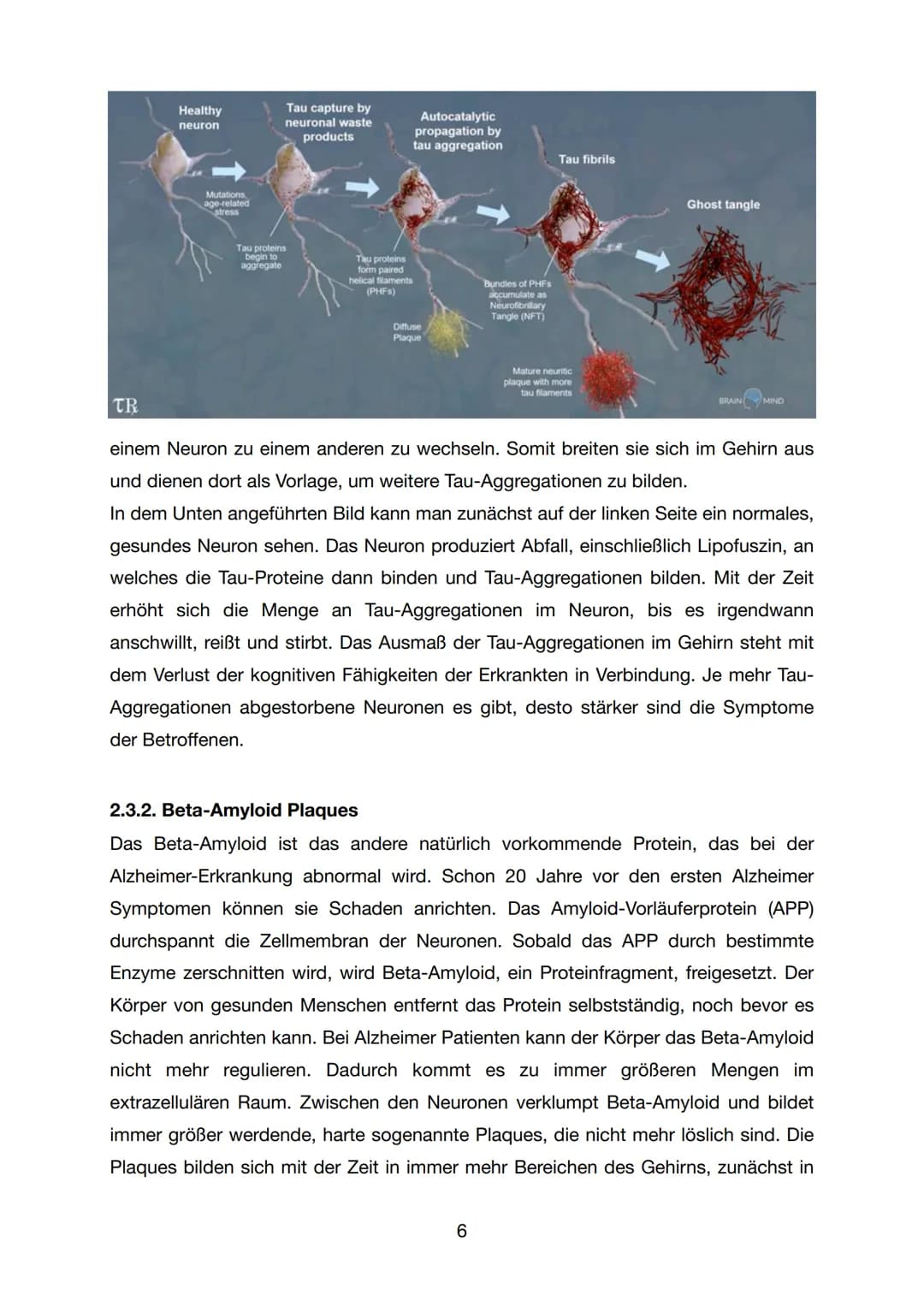 GFS - Biologie
Alzheimer
K1
07. Juli 2021
1 Inhaltsverzeichnis
1. Einleitung..
2. Hauptteil.
2.1 Was ist Alzheimer / Demenz...
2.2 Forschung