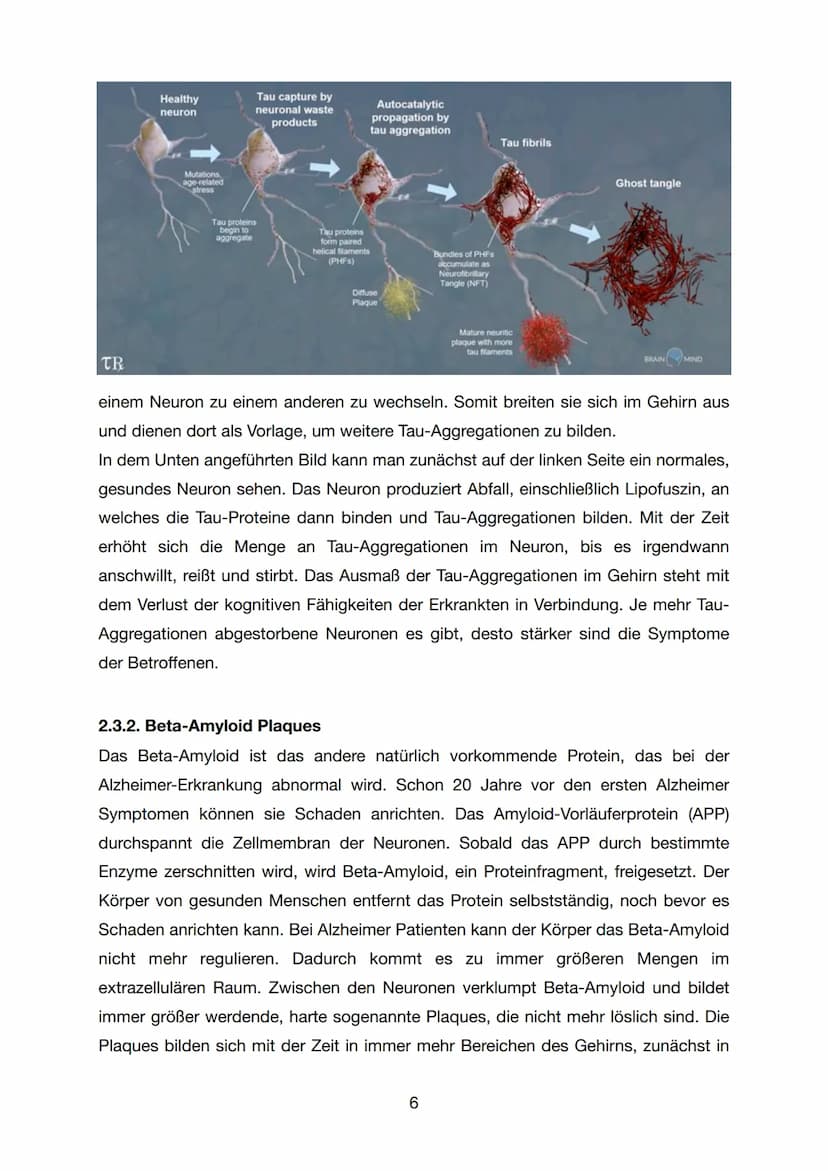 GFS - Biologie
Alzheimer
K1
07. Juli 2021
1 Inhaltsverzeichnis
1. Einleitung..
2. Hauptteil.
2.1 Was ist Alzheimer / Demenz...
2.2 Forschung