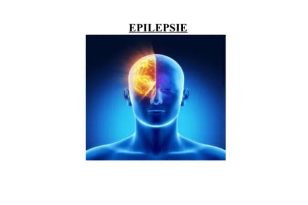 Know EPILEPSIE  thumbnail