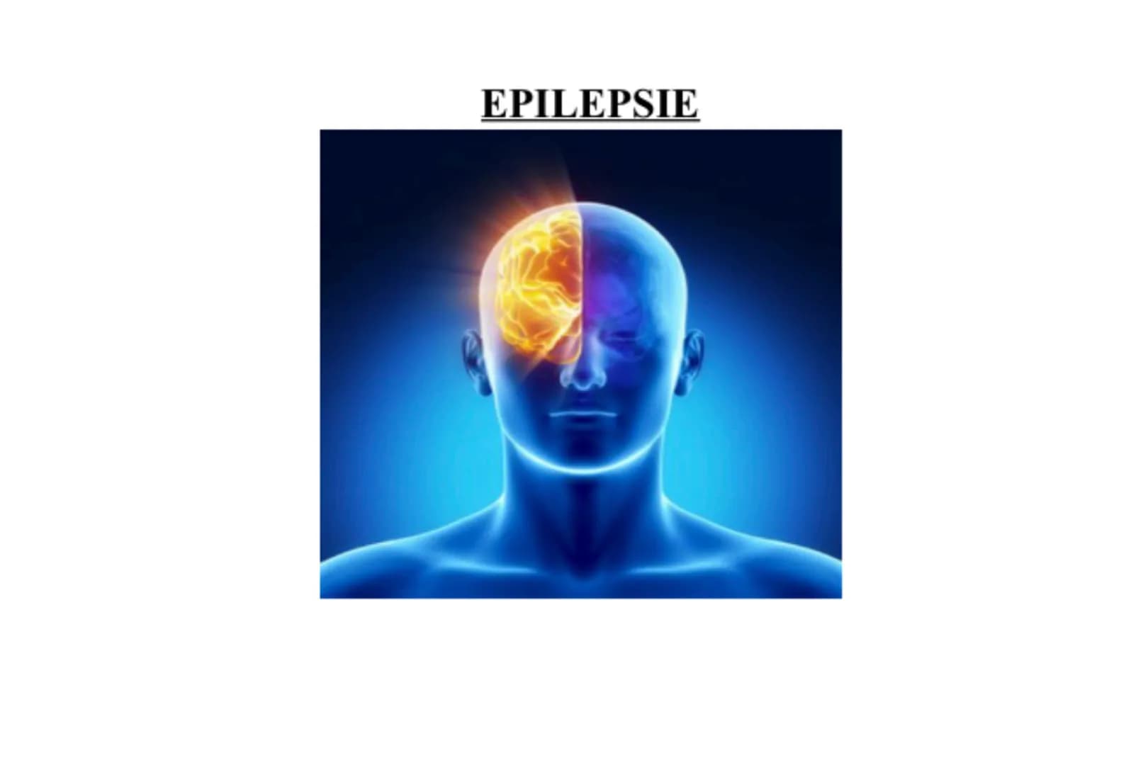 EPILEPSIE 6.
1.
5.
INHALTSVERZEICHNIS:
Definition von Epilepsie
Ursachen
Arten und Phasen
Behandlung
Erste Hilfe - Was tun bei einem Krampfa