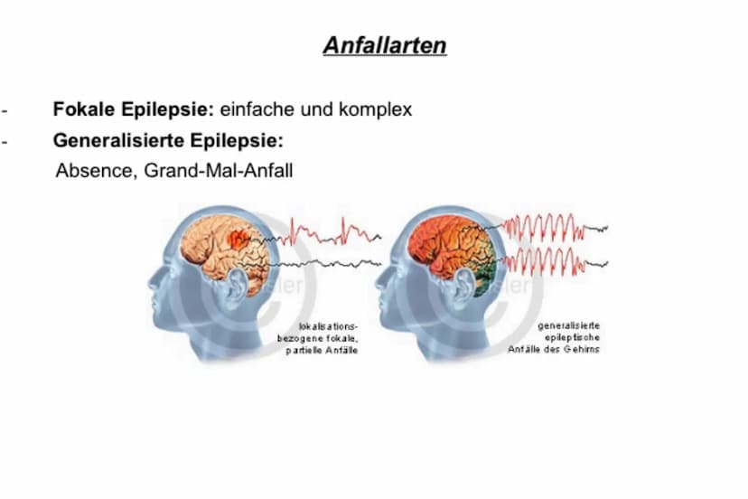 EPILEPSIE 6.
1.
5.
INHALTSVERZEICHNIS:
Definition von Epilepsie
Ursachen
Arten und Phasen
Behandlung
Erste Hilfe - Was tun bei einem Krampfa