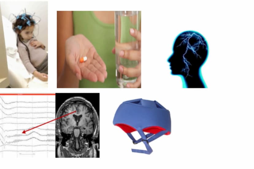 EPILEPSIE 6.
1.
5.
INHALTSVERZEICHNIS:
Definition von Epilepsie
Ursachen
Arten und Phasen
Behandlung
Erste Hilfe - Was tun bei einem Krampfa