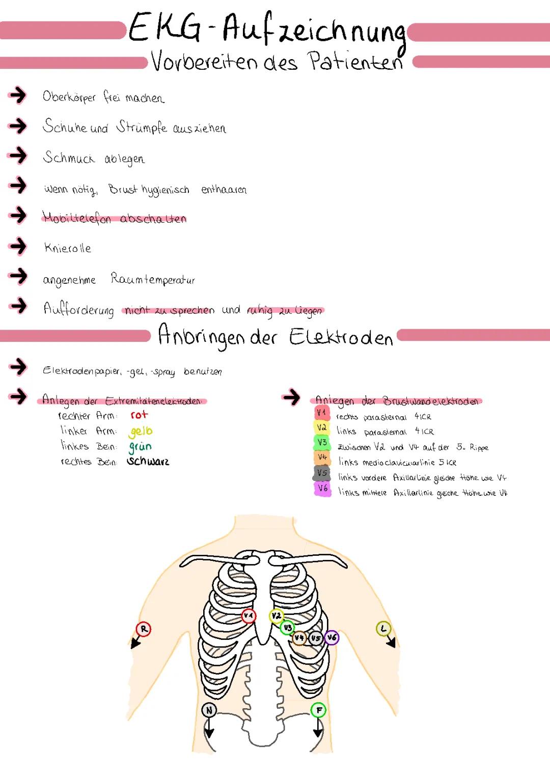 EKG-Aufzeichnung