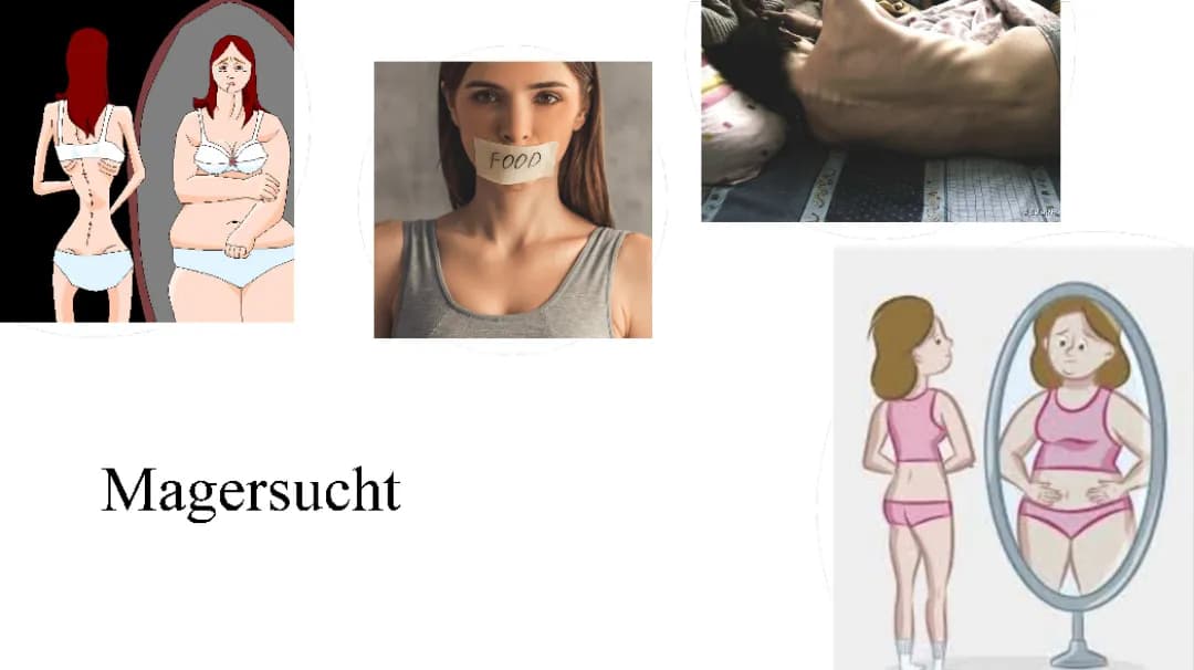 Magersucht 
