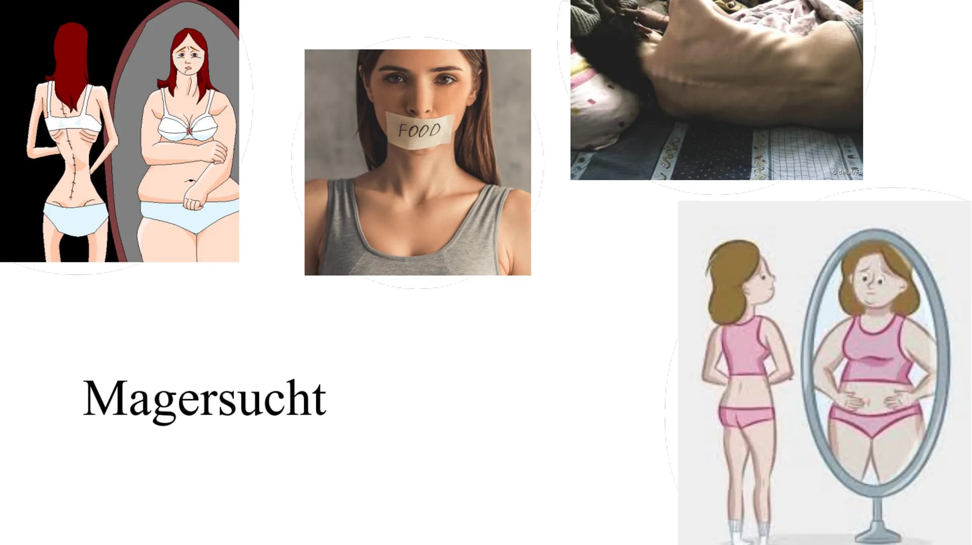 Magersucht
FOOD
delet/Fo Gliederung:
1.
2.
3.
4.
5.
6.
7.
8.
9.
10.
Was ist Magersucht?
Wer ist betroffen?
Ursachen für Magersucht
Woran erk