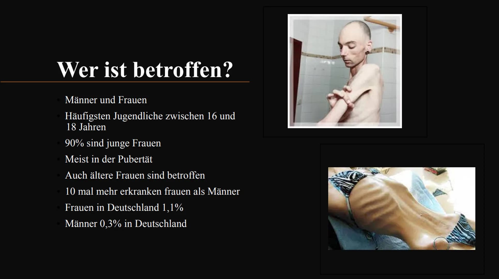 Magersucht
FOOD
delet/Fo Gliederung:
1.
2.
3.
4.
5.
6.
7.
8.
9.
10.
Was ist Magersucht?
Wer ist betroffen?
Ursachen für Magersucht
Woran erk