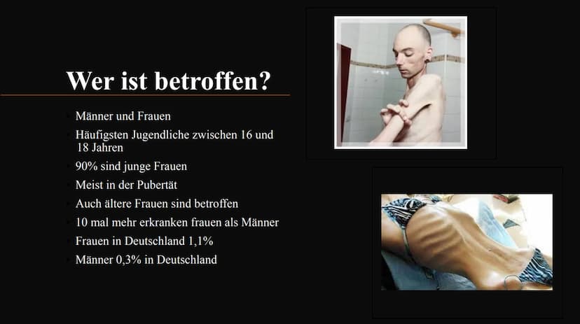 Magersucht
FOOD
delet/Fo Gliederung:
1.
2.
3.
4.
5.
6.
7.
8.
9.
10.
Was ist Magersucht?
Wer ist betroffen?
Ursachen für Magersucht
Woran erk