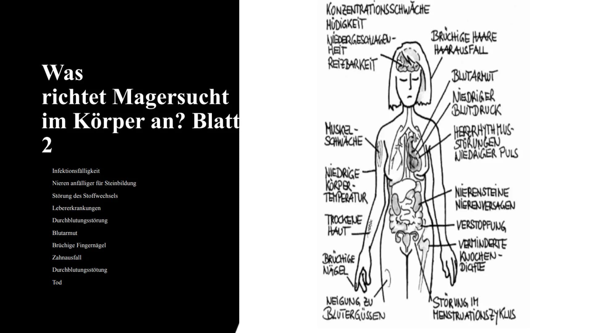 Magersucht
FOOD
delet/Fo Gliederung:
1.
2.
3.
4.
5.
6.
7.
8.
9.
10.
Was ist Magersucht?
Wer ist betroffen?
Ursachen für Magersucht
Woran erk
