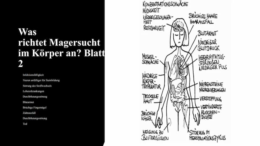 Magersucht
FOOD
delet/Fo Gliederung:
1.
2.
3.
4.
5.
6.
7.
8.
9.
10.
Was ist Magersucht?
Wer ist betroffen?
Ursachen für Magersucht
Woran erk