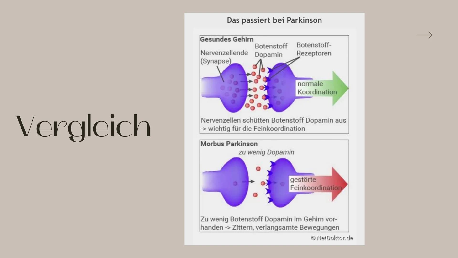 Bilogie Q2 LEhM
Parkinson
Präsentation von Sophie Priesel
т ITO
Inhaltsverzeichnis
Behandelte Themen
1. Allgemeine Informationen
2. Entstehu