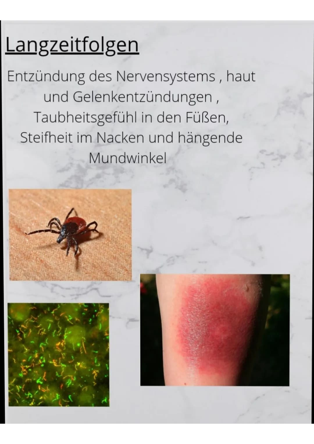 Infektionskrankheiten 