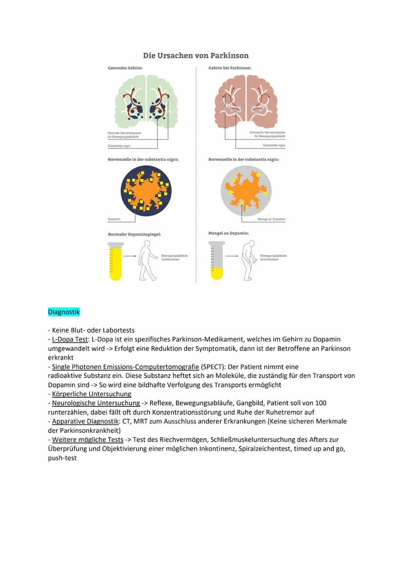 Examen: Morbus Parkinson
Gliederung
Definition
Allgemein
Ursachen
Diagnostik
Therapie
Symptome
Formen
Medikamente
Prophylaxen
Pflegemaßnahme