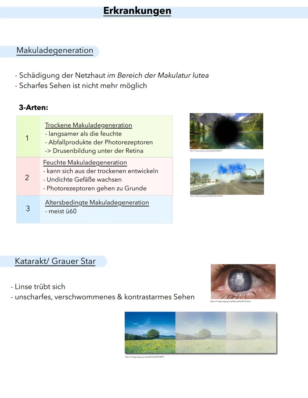 Anatomie
Macula lutea
Gelber Fleck
Erregungsleitung
Sehnervpapille (15)
Blinder Fleck
16
Funktion
Schutz Stabilsierung
Nährstelt 10 versorgu