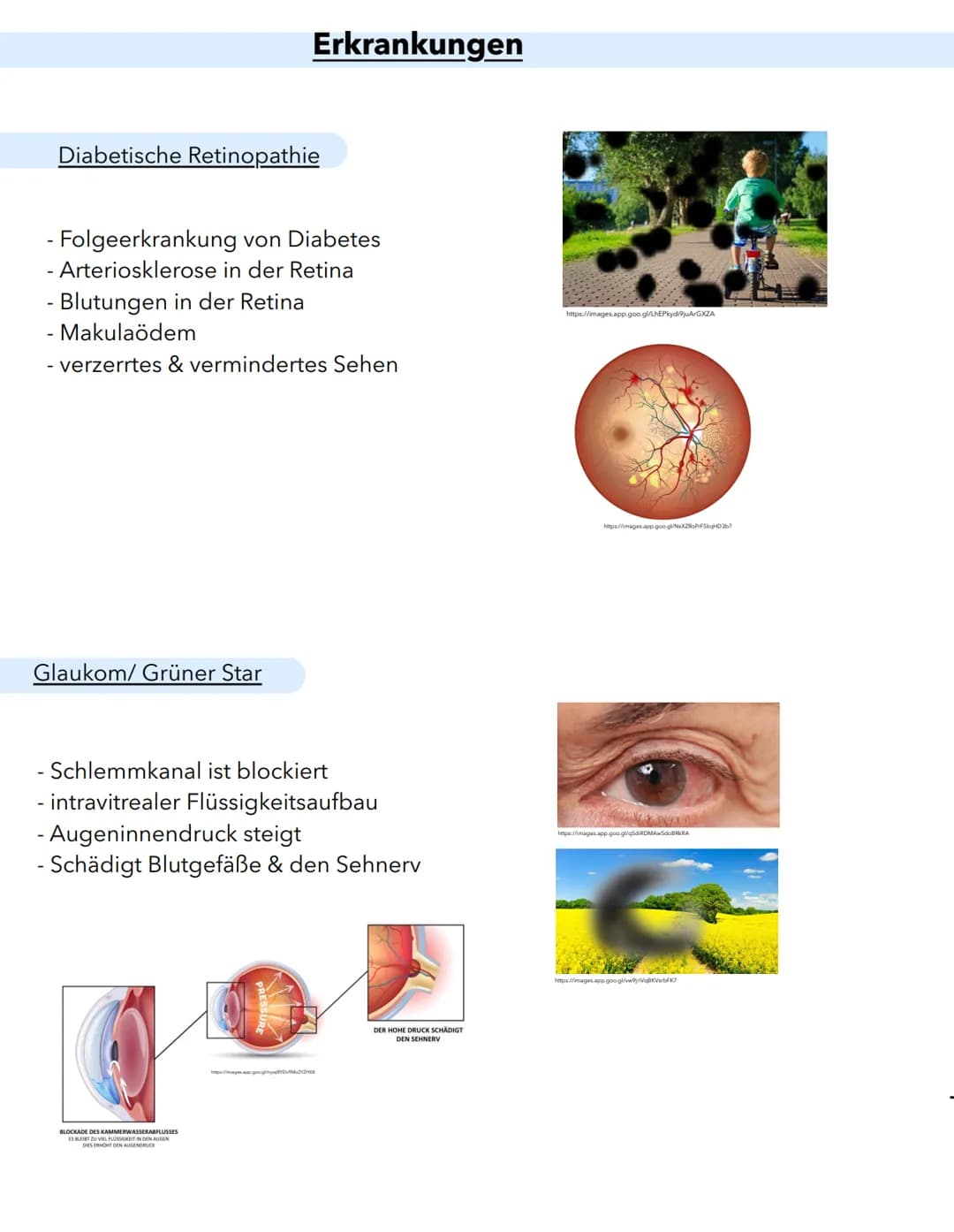 Anatomie
Macula lutea
Gelber Fleck
Erregungsleitung
Sehnervpapille (15)
Blinder Fleck
16
Funktion
Schutz Stabilsierung
Nährstelt 10 versorgu