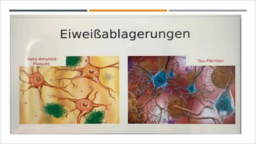 ALZHEIMER
VON Z. GENCARSLAN UND C. YESILKAYA GLIEDERUNG
■
I
I
■
Geschichte
Was ist Demenz?
Was ist Alzheimer?
Symptome
Was passiert im Gehir