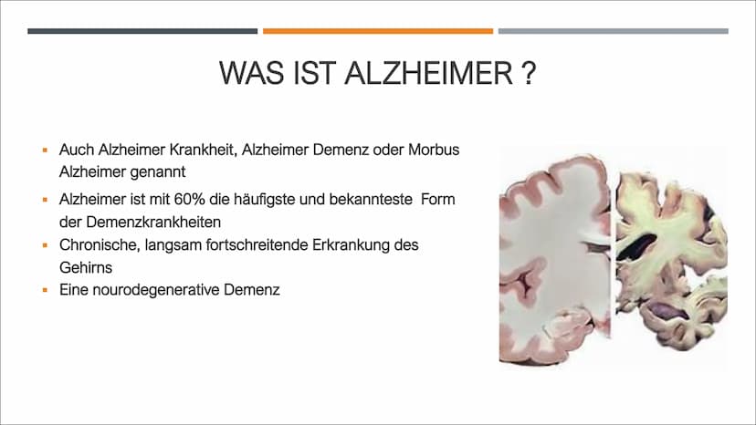 ALZHEIMER
VON Z. GENCARSLAN UND C. YESILKAYA GLIEDERUNG
■
I
I
■
Geschichte
Was ist Demenz?
Was ist Alzheimer?
Symptome
Was passiert im Gehir