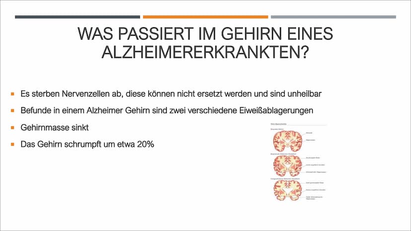 ALZHEIMER
VON Z. GENCARSLAN UND C. YESILKAYA GLIEDERUNG
■
I
I
■
Geschichte
Was ist Demenz?
Was ist Alzheimer?
Symptome
Was passiert im Gehir
