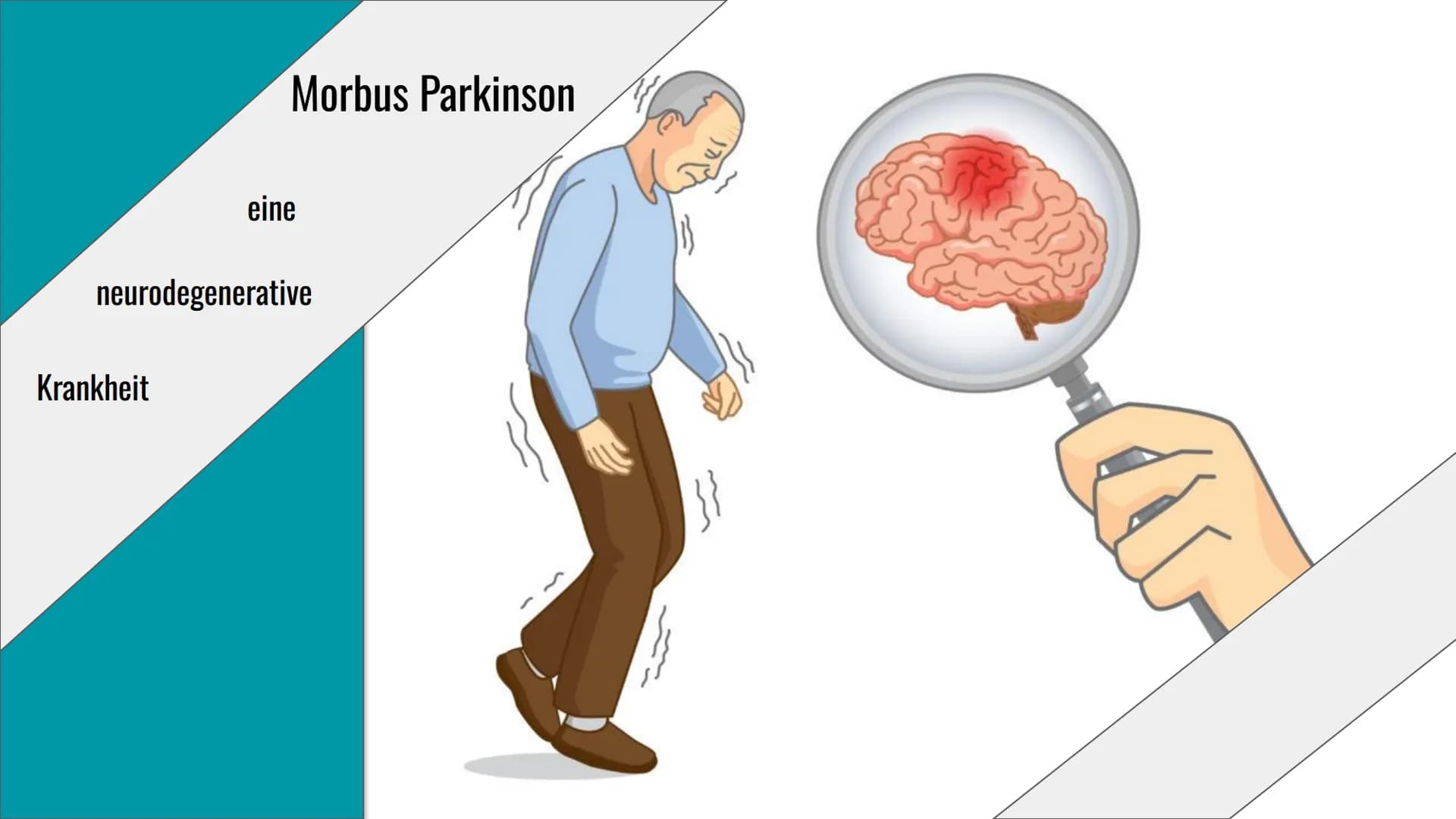 Morbus Parkinson
Krankheit
eine
neurodegenerative
}} Inhaltsverzeichnis
1. Definition
2. Symptome & Erkennungsmerkmale
3. Formen von Morbus 