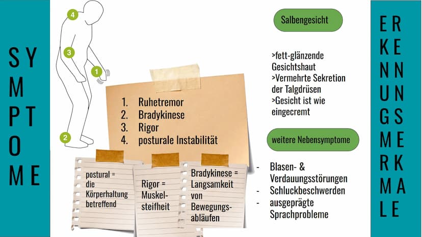 Morbus Parkinson
Krankheit
eine
neurodegenerative
}} Inhaltsverzeichnis
1. Definition
2. Symptome & Erkennungsmerkmale
3. Formen von Morbus 