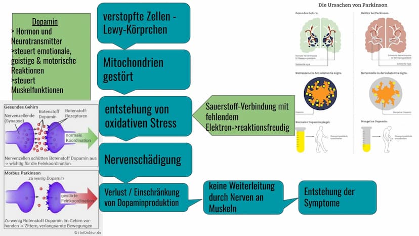 Morbus Parkinson
Krankheit
eine
neurodegenerative
}} Inhaltsverzeichnis
1. Definition
2. Symptome & Erkennungsmerkmale
3. Formen von Morbus 