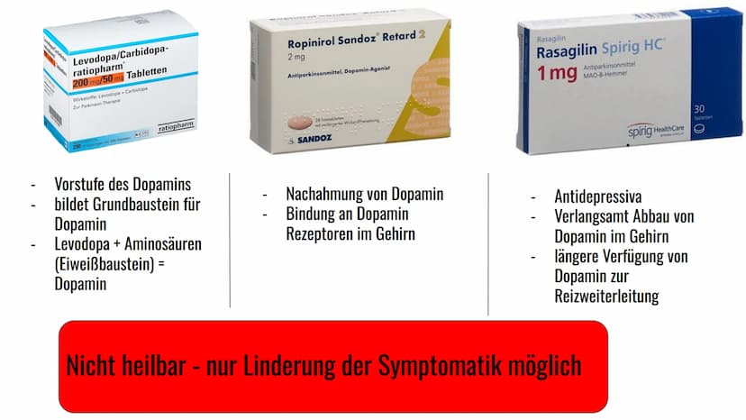 Morbus Parkinson
Krankheit
eine
neurodegenerative
}} Inhaltsverzeichnis
1. Definition
2. Symptome & Erkennungsmerkmale
3. Formen von Morbus 