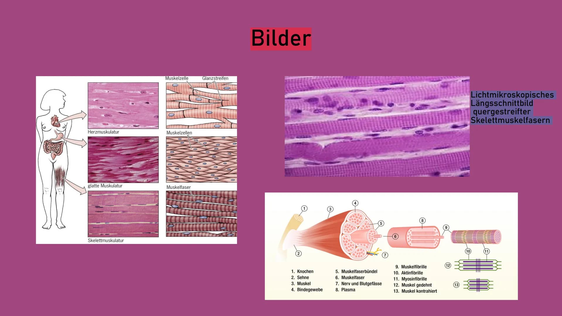 Pectoralis Major
Deltoid
Biceps
Palmaris Longus
Flexor Carpi Radialis
Brachioradialis
Flexor Digitorum
Superficialis
Lubrical
Gluteus Medius